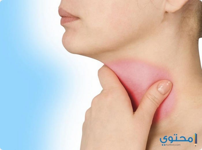 علاج جفاف الحلق وأسباب حدوثة